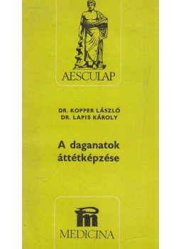 Kopper László, Lapis Károly - A daganatok áttétképzése Kopper László, Lapis Károly - A daganatok áttétképzése, Budapest 1985 antikvár könyv