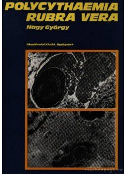 Nagy György - Polycythaemia Rubra Vera Nagy György - Polycythaemia Rubra Vera, Budapest 1979 antikvár könyv