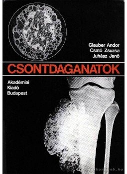 Glauber Andor, Csató Zsuzsa, Juhász Jenő - Csontdaganatok Glauber Andor, Csató Zsuzsa, Juhász Jenő - Csontdaganatok, Budapest 1980 antikvár könyv