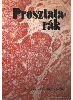 Dr. Pintér József (szerk.) - Proszatatarák Dr. Pintér József (szerk.) - Proszatatarák, Budapest 1984 antikvár könyv