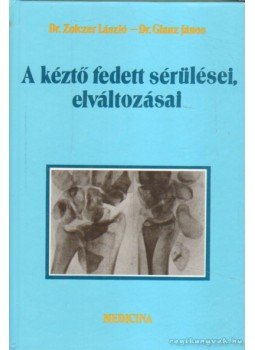 Dr. Zolczer László, Dr. Glanz János - A kéztő fedett sérülései, elváltozásai, Budapest 1995 antikvár könyv