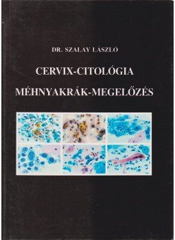 Dr. Szalay László - Cervix-citológia Dr. Szalay László - Cervix-citológia, 1987 antikvár könyv