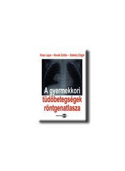 Kósa Lajos, Székely Edgár - A gyermekkori tüdőbetegségek röntgenatlasza Kósa Lajos, Székely Edgár - A gyermekkori tüdőbetegségek röntgenatlasza, null 2004 antikvár könyv