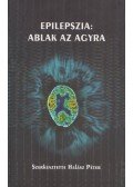 Halász Péter - Epilepszia: Ablak az agyra