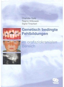 OPITZ, CHARLOTTE – WITKOWSKI, REGINE – TINSCHERT, SIGRID - Genetisch bedingte Fehlbildungen im orofaziokranialen Bereich, null 2001 antikvár könyv