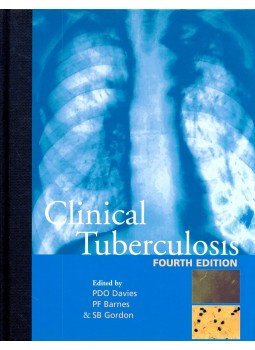 DAVIES, PETER DO – BARNES, PETER, F – GORDON, STEPHEN B (ed) - Clinical Tuberculosis DAVIES, PETER DO – BARNES, PETER, F – GORDON, STEPHEN B (ed) - Clinical Tuberculosis, null 2008 antikvár könyv