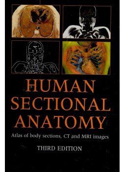 ELLIS, HAROLD – LOGAN, BARI M. - DIXON, ADRIAN K. - Human Sectional Anatomy – Atlas of Body Sections, CT and MRI Images, null 2007 antikvár könyv
