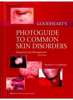 GOODHEART, HERBERT P. - Goodheart's Photoguide to Common Skin Disorders, null 2009 antikvár könyv
