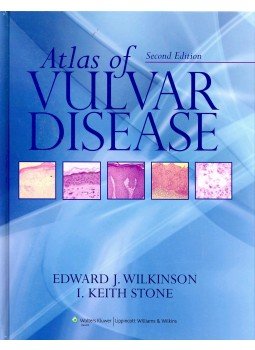 WILKINSON, EDWARD J. - STONE I. KEITH - Atlas of Vulvar Disease, null 2008 antikvár könyv