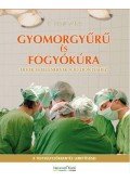 Dr. Csiszár Miklós  - Gyomorgyűrű és fogyókúra - Érvek és ellenérvek a jó döntéshez