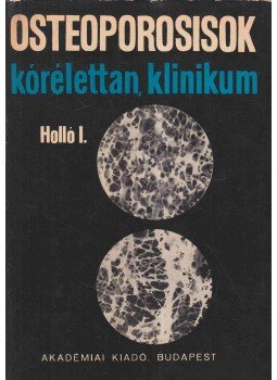 Holló István - Osteoporosisok Holló István - Osteoporosisok, Budapest 1967 antikvár könyv