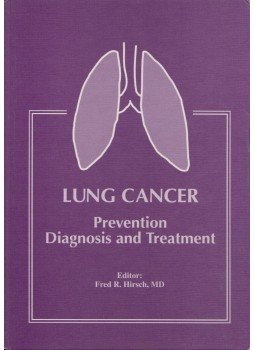 Fred R. Hirsch - Lung Cancer Fred R. Hirsch - Lung Cancer, 0 antikvár könyv