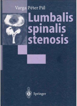 Varga Péter Pál - Lumbalis spinalis stenosis (Dedikált) Varga Péter Pál - Lumbalis spinalis stenosis (Dedikált), Budapest 1995 antikvár könyv