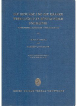 Georg Schmorl, Herbert Junhanns - Die gesunde und die kranke Wirbelsäule in Röntgenbild und Klinik, Stuttgart 1953 antikvár könyv