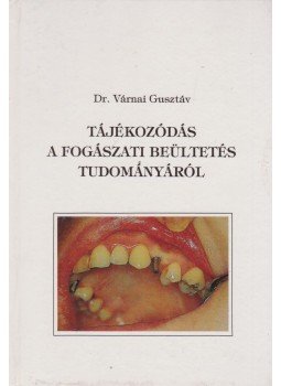 Várnai Gusztáv - Tájékozódás a fogászati beültetés tudományáról,  1994 antikvár könyv