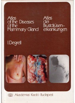 I. Degrell - Atlas of the Diseases of the Mammary Gland / Atlas Der Brustdrusenerkrankungen, Budapest 1976 antikvár könyv