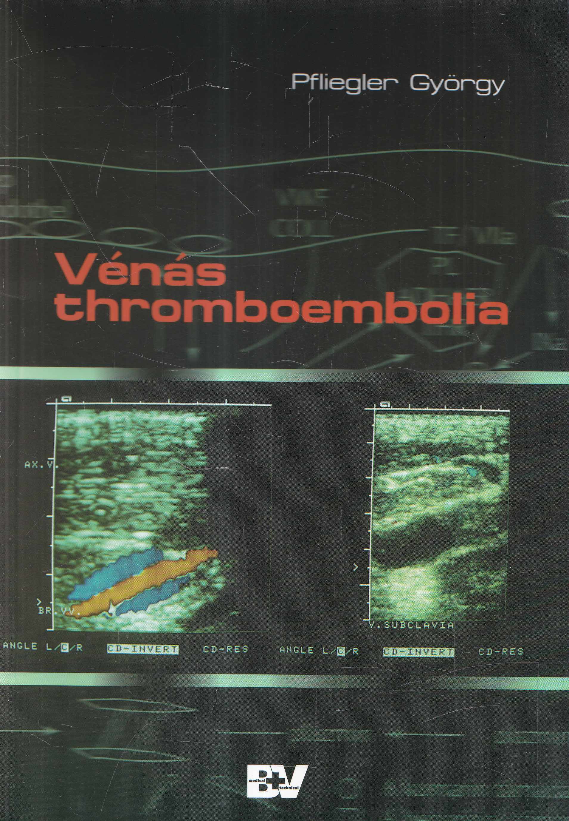 Pfliegler György - Vénás thromboembolia,  1995 antikvár könyv