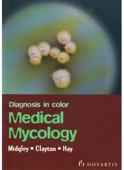 Midgley, Gillian, Clayton, Yvonne M, Hay, Roderick J - Diagnosis in Color Medical Mycology, London 1997 antikvár könyv