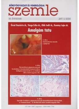 Temesvári Erzsébet dr. - Bőrgyógyászati és venerológiai szemle 83. évf. 2007. 4. szám Temesvári Erzsébet dr. - Bőrgyógyászati és venerológiai szemle 83. évf. 2007. 4. szám, 2007 antikvár könyv