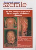 Temesvári Erzsébet dr. - Bőrgyógyászati és venerológiai szemle 81. évf. 2005. 3. szám