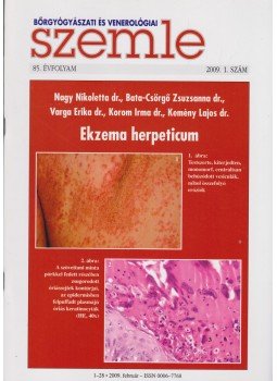 Temesvári Erzsébet dr. - Bőrgyógyászati és venerológiai szemle 85. évf. 2009. 1. szám Temesvári Erzsébet dr. - Bőrgyógyászati és venerológiai szemle 85. évf. 2009. 1. szám, 2009 antikvár könyv