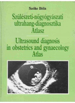 Szőke Béla - Szülészeti-nőgyógyászati ultrahang-diagnosztika Atlasz, Budapest 1992 antikvár könyv