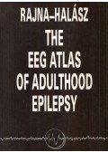 Dr. Rajna Péter,Dr. Halász Péter - The EEG Atlas of Adulthood Epilepsy