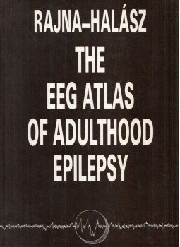 Dr. Rajna Péter, Dr. Halász Péter - The EEG Atlas of Adulthood Epilepsy Dr. Rajna Péter, Dr. Halász Péter - The EEG Atlas of Adulthood Epilepsy, Budapest 1990 antikvár könyv