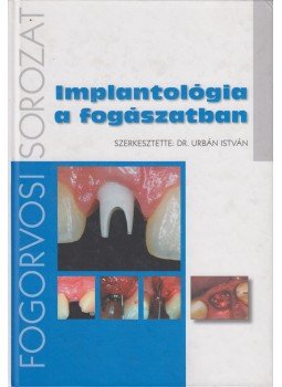 Dr. Urbán István - Implantológia a fogászatban, Budapest 0 antikvár könyv