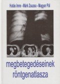 Hutás Imre,Márk Zsuzsa,Magyar Pál - A tüdő megbetegedéseinek röntgenatlasza