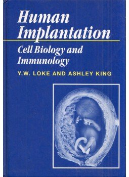 Y. W. Loke, Ashley King - Human Implantation: Cell Biology and Immunology Y. W. Loke, Ashley King - Human Implantation: Cell Biology and Immunology, Cambridge, Cambridgeshire 1995 antikvár könyv