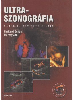 Harkányi Zoltán, Morvay Zita - Ultraszonográfia Harkányi Zoltán, Morvay Zita - Ultraszonográfia, Budapest 2006 antikvár könyv