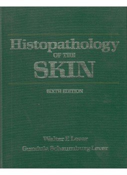 Walter F. Lever, Gundula Schaumburg-Lever - Histopathology of the Skin, London 1983 antikvár könyv
