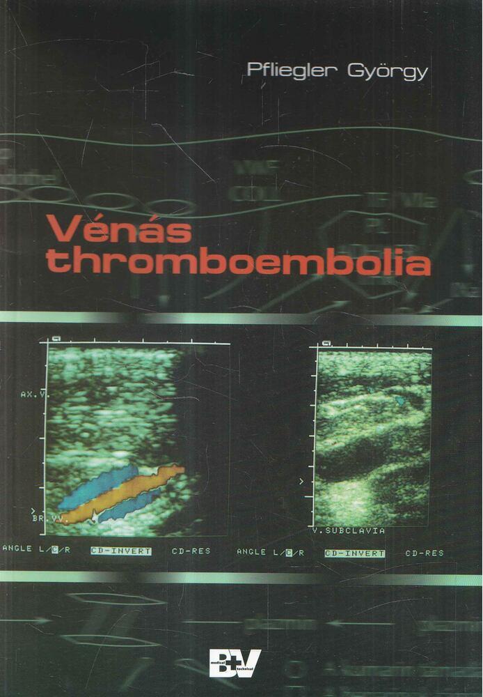 Pfliegler György - Vénás thromboembolia