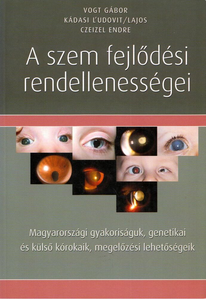 Vogt Gábor,Kádasi L'udovit,Czeizel Endre - A szem fejlődési rendellenességei