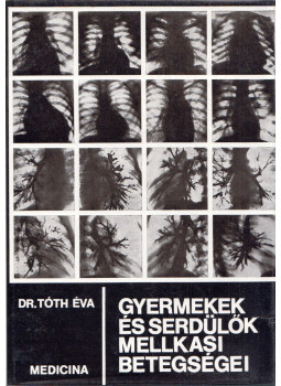 Tóth Éva - Gyermekek és serdülők mellkasi betegségei Tóth Éva - Gyermekek és serdülők mellkasi betegségei, Budapest 1979 antikvár könyv