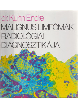 Dr. Kuhn Endre - Malignus limfómák radiológiai diagnosztikája Dr. Kuhn Endre - Malignus limfómák radiológiai diagnosztikája, BUdapest 1986 antikvár könyv