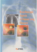 Pápai Zsolt,Szima Barna,János Strausz - Bronchoscopic Aspects of Human Lung Diseases (dedikált)