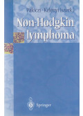 Több szerző,Pálóczi Katalin,Kelényi Gábor - Non-Hodgkin lymphoma
