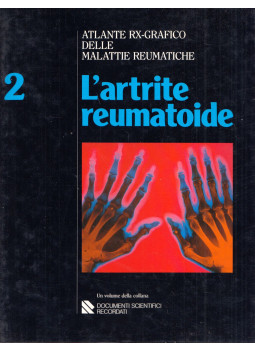 I. Caruso, F. Costa - Atlante RX-Grafico delle malattie reumatiche 2: L'artrite reumatoide, Milano 1985 antikvár könyv