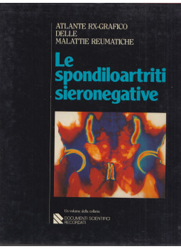 I. Caruso, F. Costa - Atlante RX-Grafico delle malattie reumatiche: Le spondiloartriti sieronegative, Milano 1987 antikvár könyv