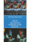 Tamás Forster,Miklós Csanády - Atlas of Colour Doppler Flow Imaging