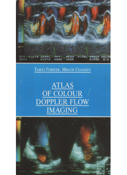 Tamás Forster, Miklós Csanády - Atlas of Colour Doppler Flow Imaging Tamás Forster, Miklós Csanády - Atlas of Colour Doppler Flow Imaging, null 0 antikvár könyv