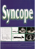 Tomcsányi János - Syncope