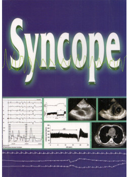 Tomcsányi János - Syncope Tomcsányi János - Syncope, null 2012 antikvár könyv