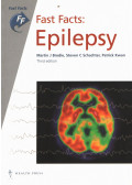 Martin J. Brodie,Steven C. Schachter,Patrick Kwan - Fast Facts: Epilepsy