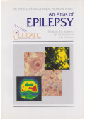 D. F. Smith,R. E. Appleton,J. M. MacKenzie,D. W. Chadwick - An Atlas of Epilepsy