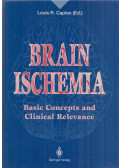 Louis R. Caplan - Brain Ischemia