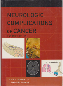 Lisa M. DeAngelis, Jerome B. Posner - Neurologic Complications of Cancer Lisa M. DeAngelis, Jerome B. Posner - Neurologic Complications of Cancer, Oxford 2009 antikvár könyv