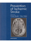 Cesare Fieschi MD,Marc Fisher - Prevention and Treatment of Ischemic Stroke